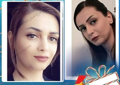 جراحی زیبایی بینی