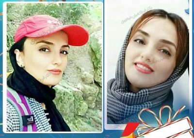 جراحی زیبایی بینی