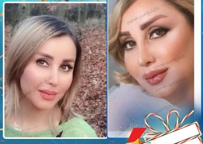 جراحی زیبایی بینی