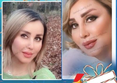 جراحی بینی استخوانی
