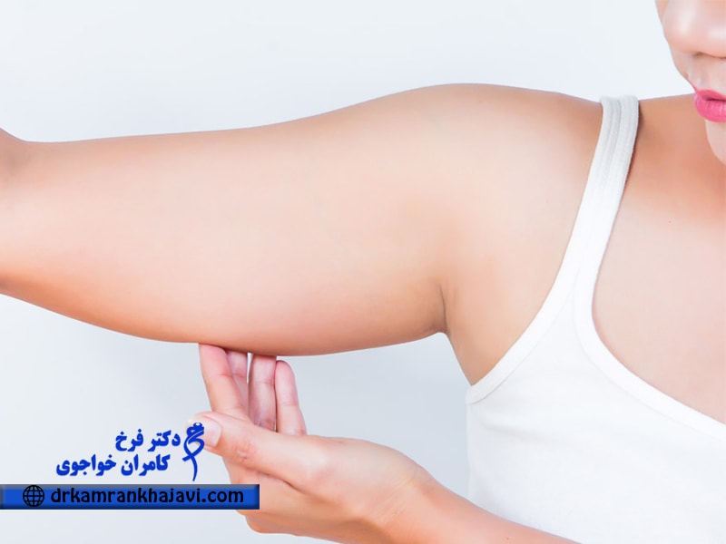 جراحی لیفت بازو، بهترین روش درمان افتادگی یا شلی بازو