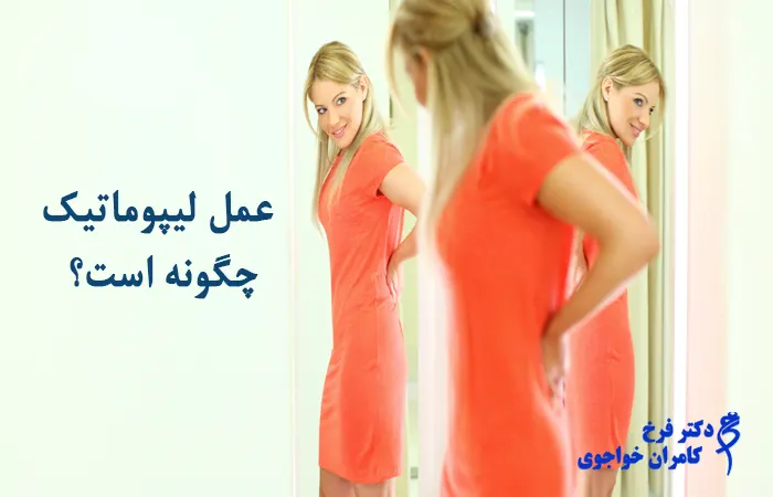 لیپوماتیک