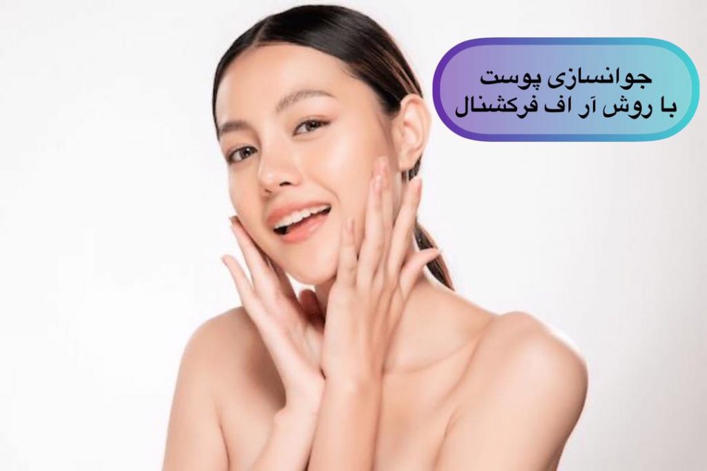مزایا آر اف فرکشنال