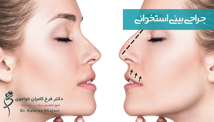 جراحی بینی استخوانی