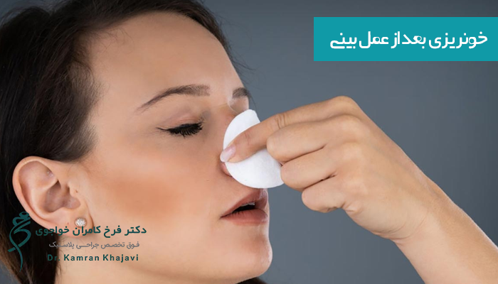 خونریزی بعد از عمل بینی 