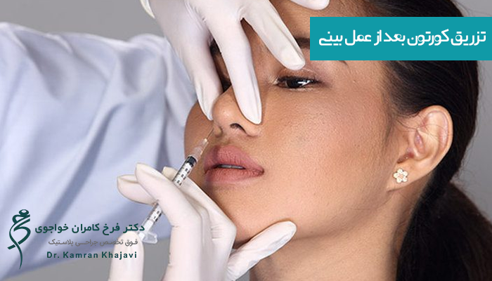 تزریق کورتون بعد از عمل بینی