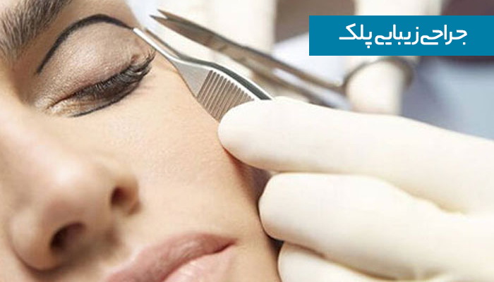 انواع جراحی زیبایی پلک 