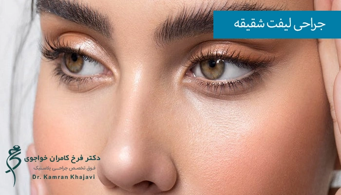 مزایای لیفت شقیقه