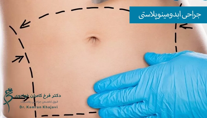 دلایل انجام ابدومینوپلاستی