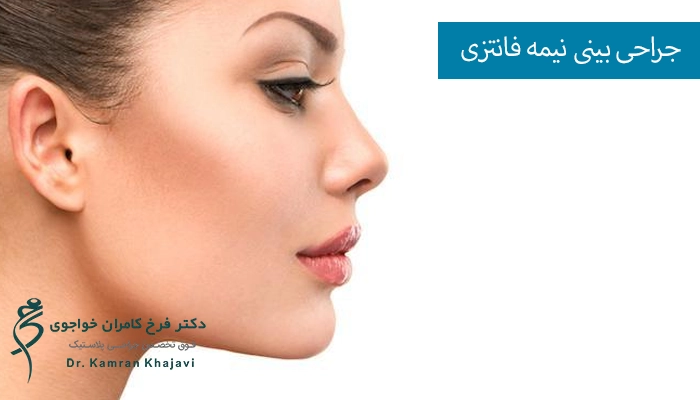 جراحی بینی نیمه فانتزی در گرگان