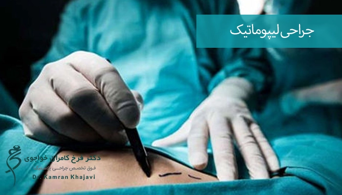 کاندید مناسب برای انجام جراحی لیپوماتیک