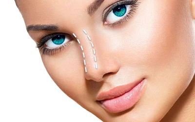 بهترین جراح بینی در گرگان + نمونه کار