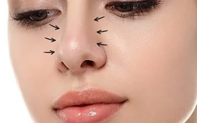 جراحی بینی گوشتی در گرگان