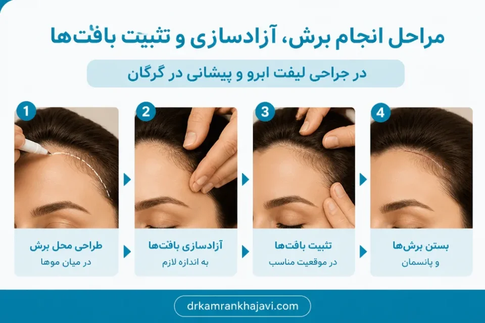 نمای توضیحی درباره انجام برش، آزادسازی و تثبیت بافتها